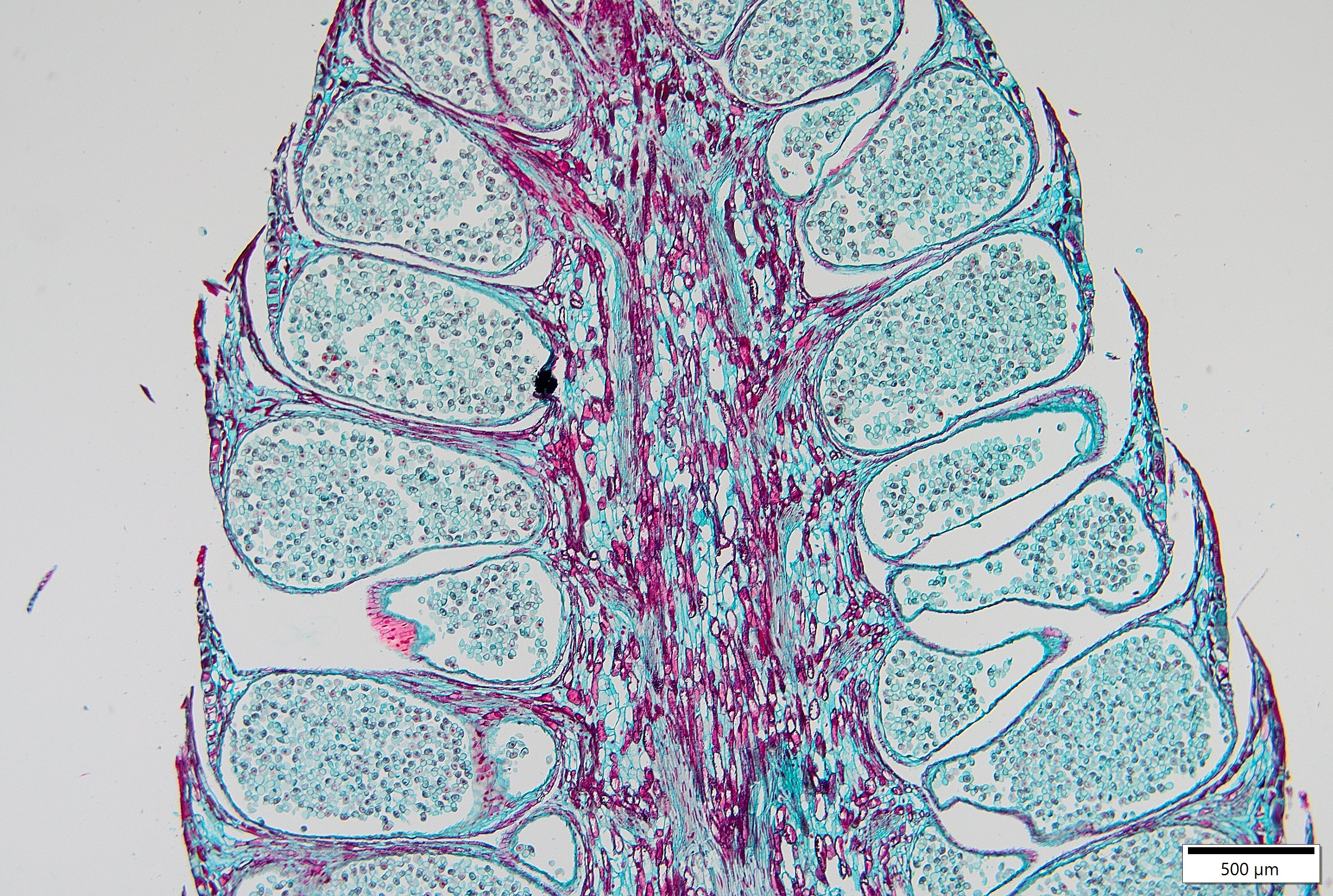 Microstrobilus Reproductive Structures